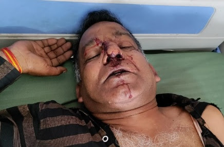 बाल्मीकि बस्ती में बिजली बंद होने पर विवाद, 62 वर्षीय व्यक्ति घायल, 5 पर केस दर्ज